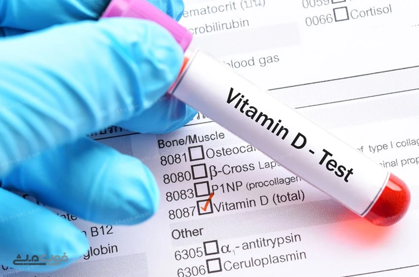 تشخیص کمبود ویتامین دی