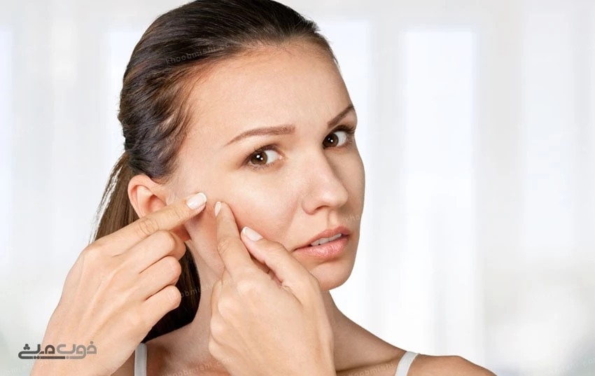 درمان خانگی جوش صورت