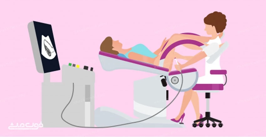 نحوه گرفتن عکس رنگی رحم