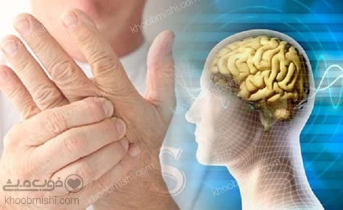 عوارض بیماری ام اس (MS)