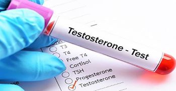 علائم و درمان تستوسترون پایین در مردان