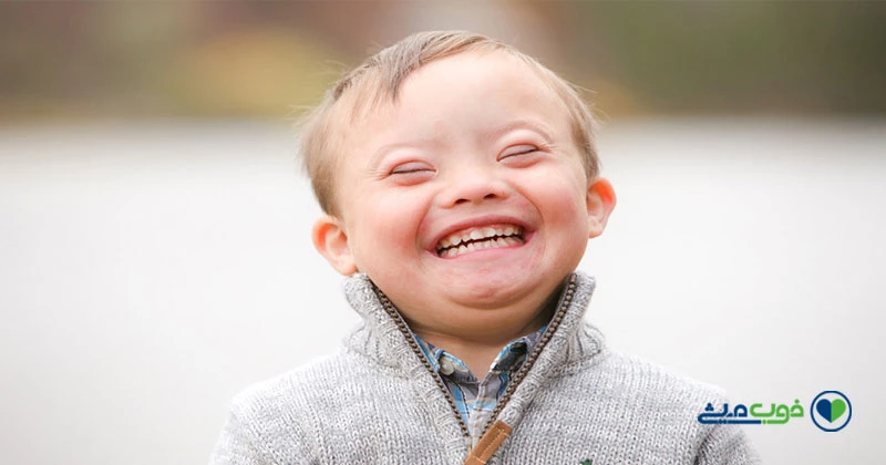 تشخیص سندرم داون در غربالگری دوم