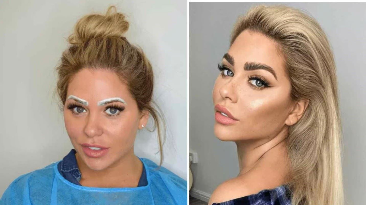 خوابیدن بعد از کاشت ابرو چگونه است؟