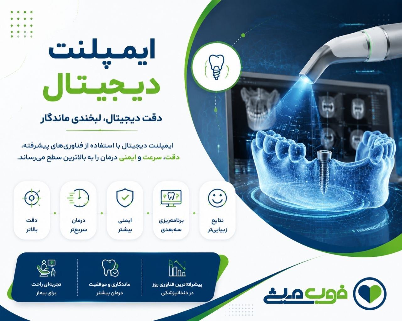 ایمپلنت دیجیتال