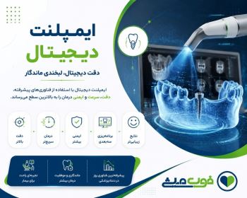 ایمپلنت دیجیتال