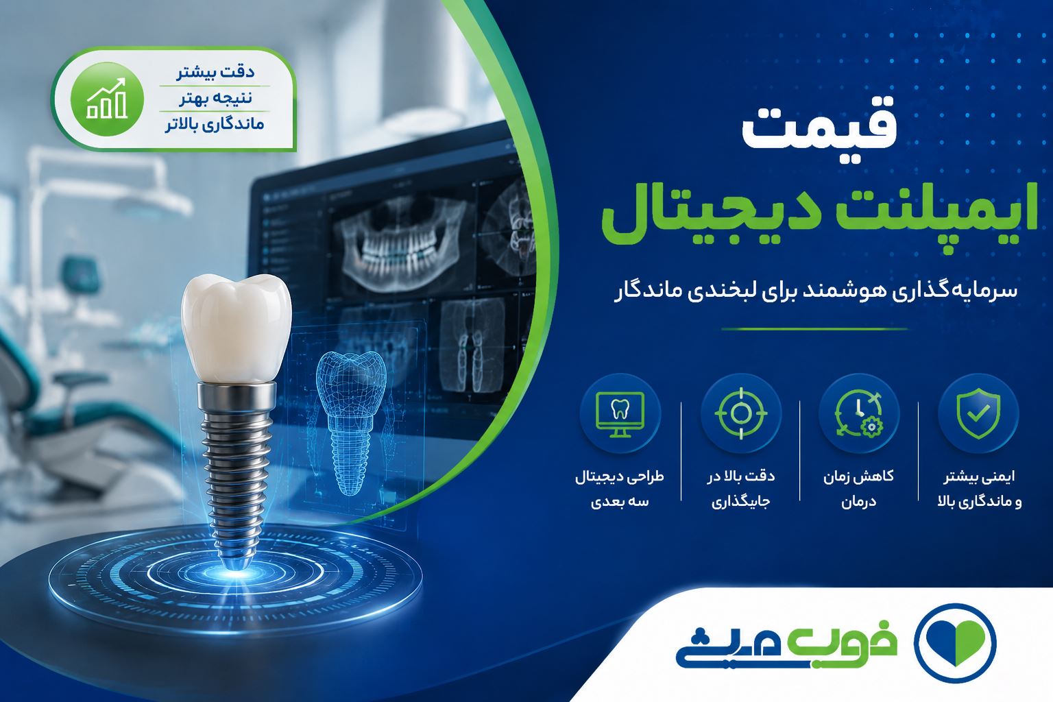 قیمت ایمپلنت دیجیتال