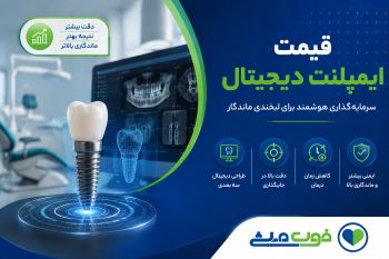 قیمت ایمپلنت دیجیتال