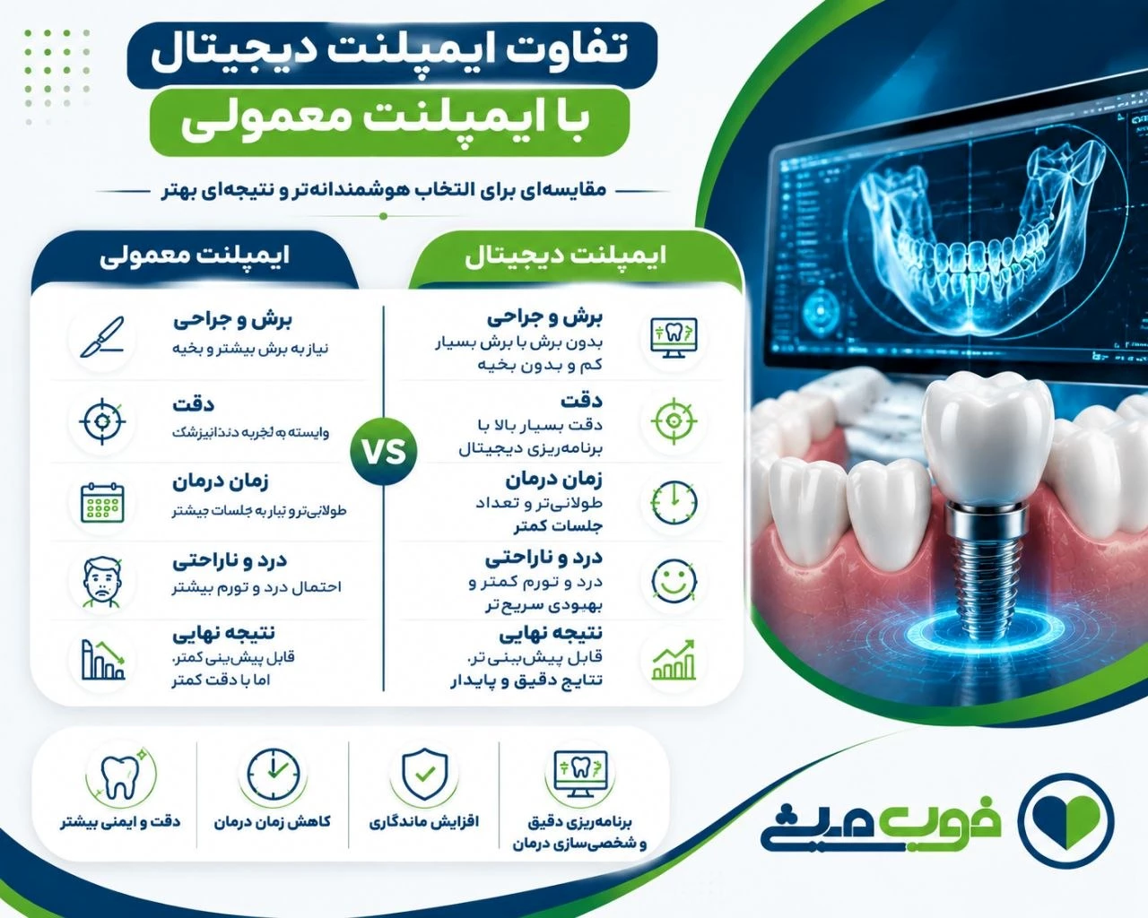 تفاوت ایمپلنت دیجیتال با ایمپلنت معمولی
