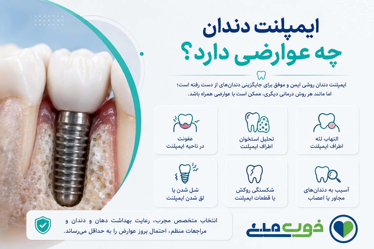 ایمپلنت دندان چه عوارضی دارد؟