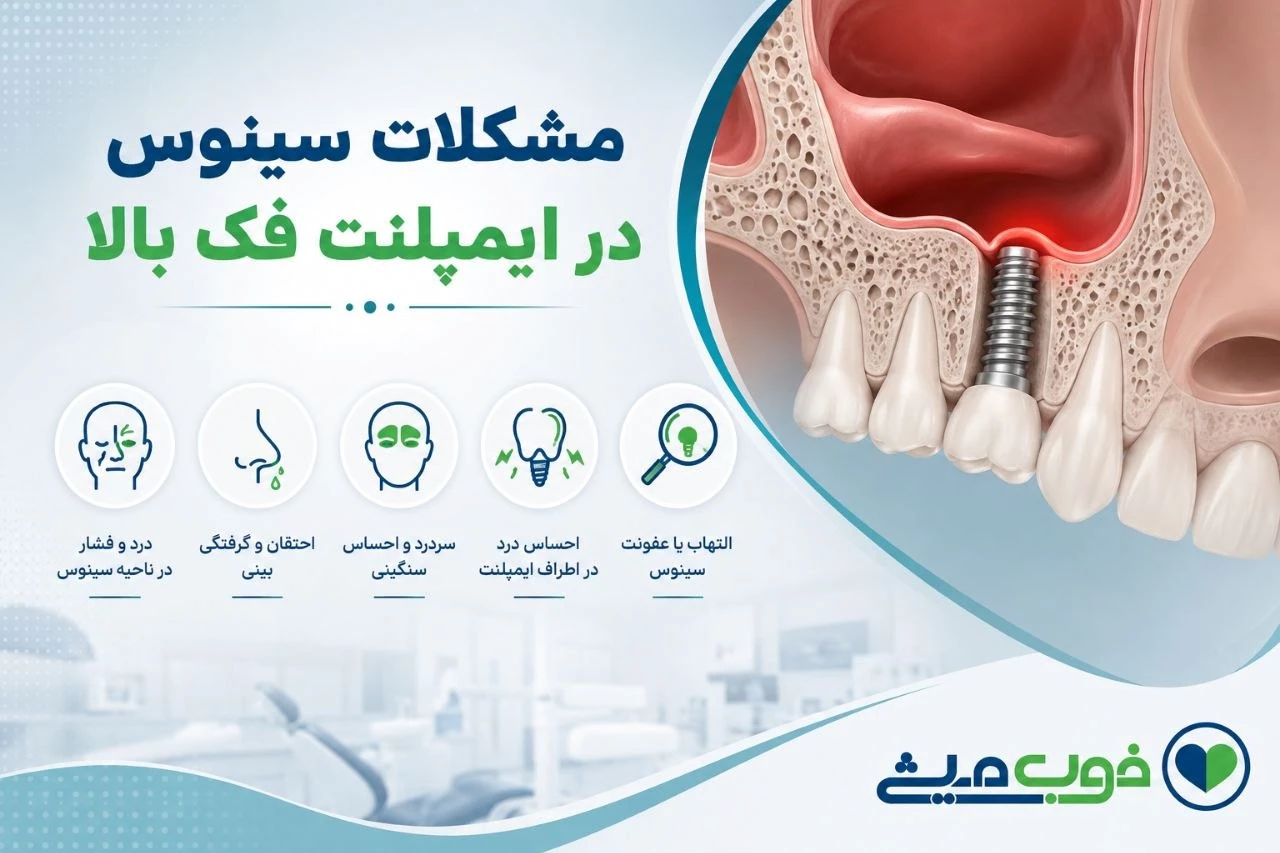 مشکلات سینوس در ایمپلنت فک بالا