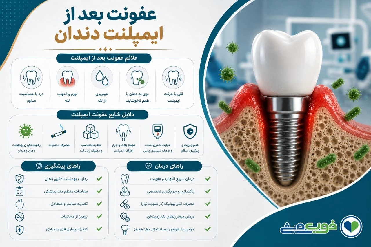 عفونت بعد از ایمپلنت دندان
