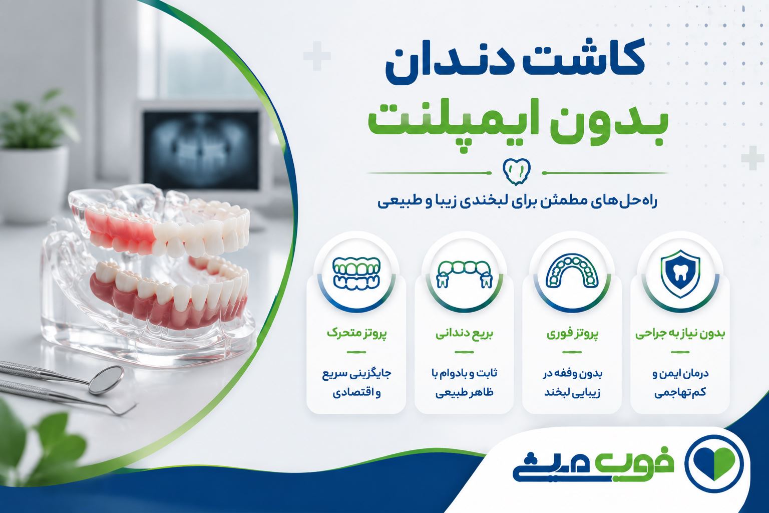 کاشت دندان بدون ایمپلنت