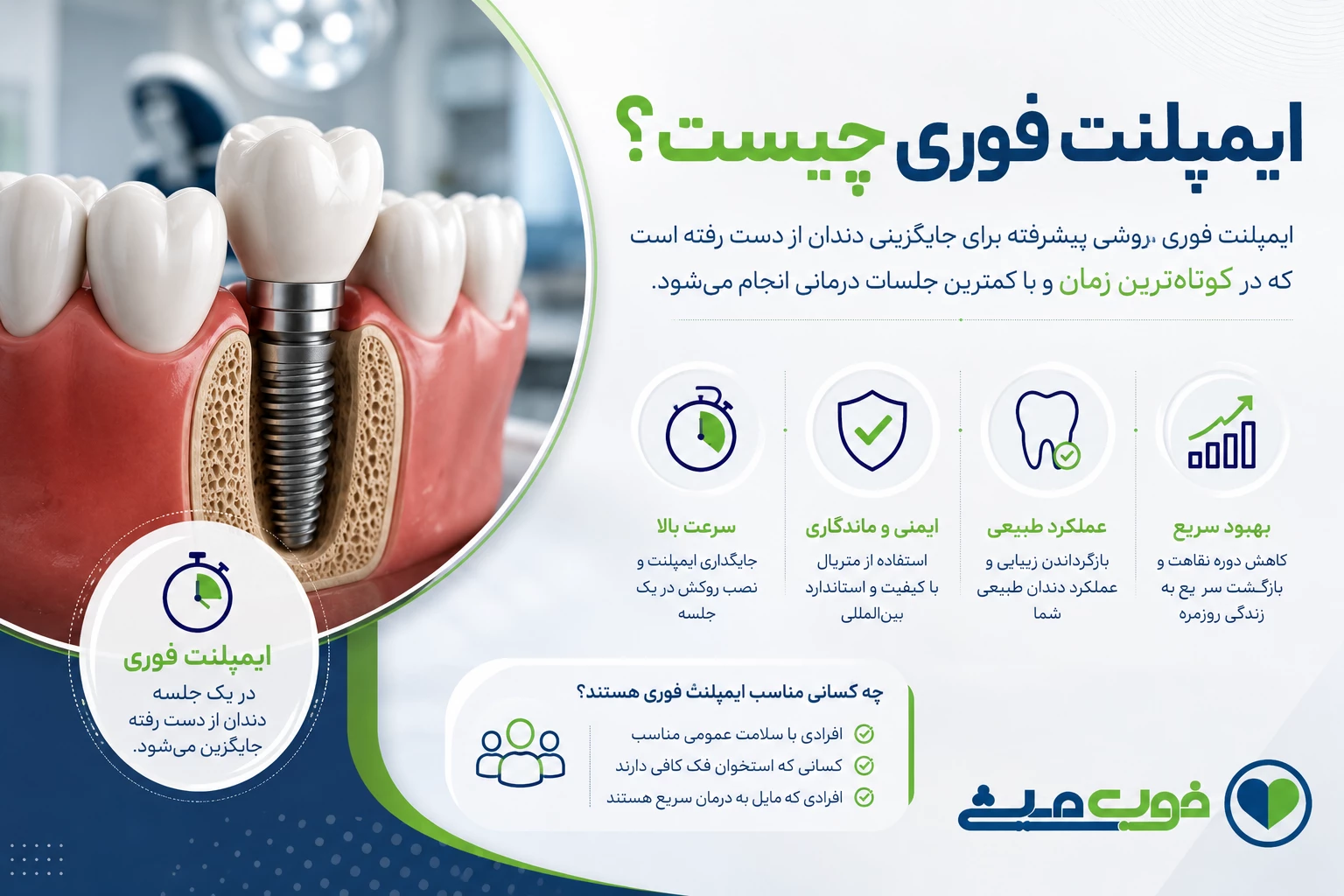 ایمپلنت فوری چیست؟