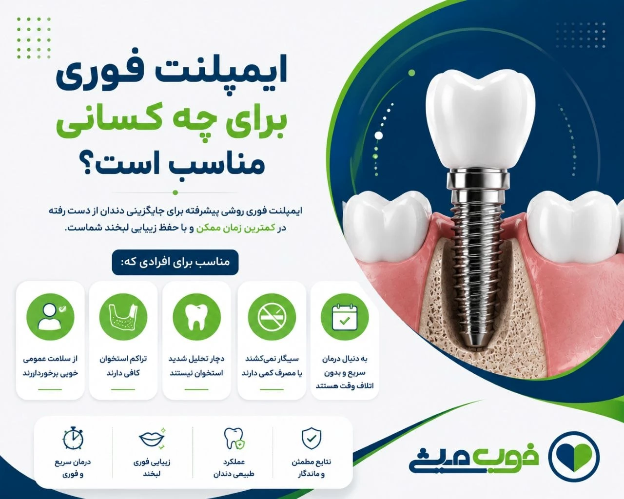 ایمپلنت فوری برای چه کسانی مناسب است؟