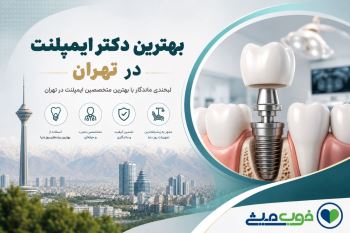 بهترین دکتر ایمپلنت در تهران | معرفی بهترین متخصصان ایمپلنت دندان + لیست 1405