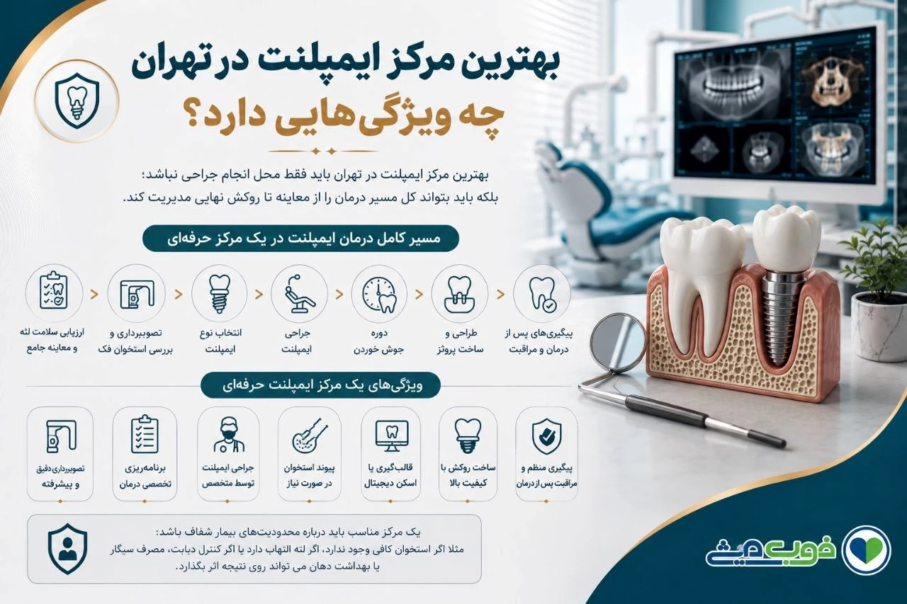 بهترین مرکز ایمپلنت در تهران چه ویژگیهایی دارد؟