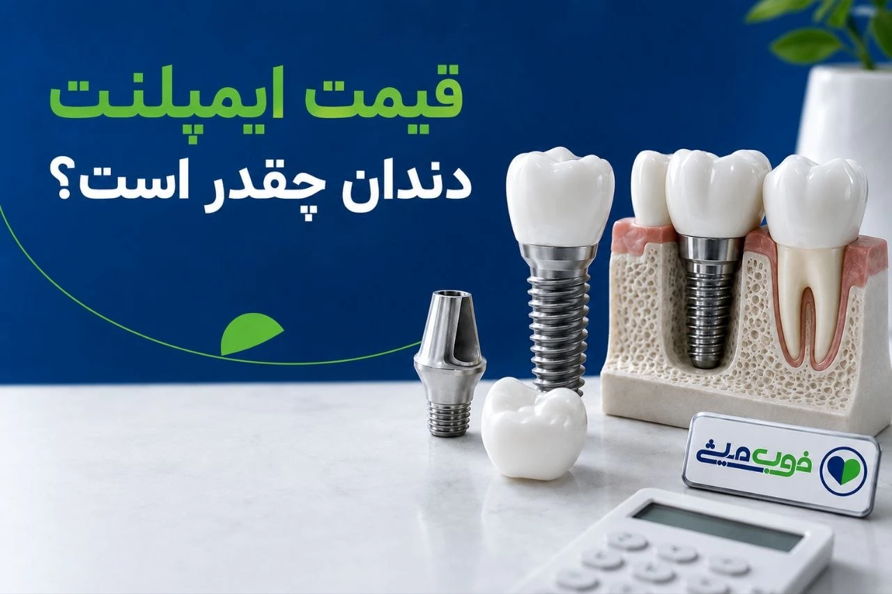 قیمت ایمپلنت دندان چقدر است؟