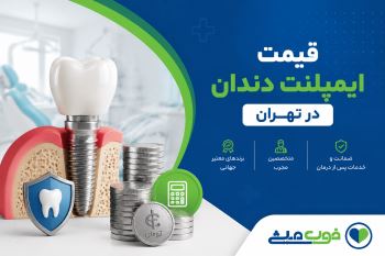 قیمت ایمپلنت دندان 