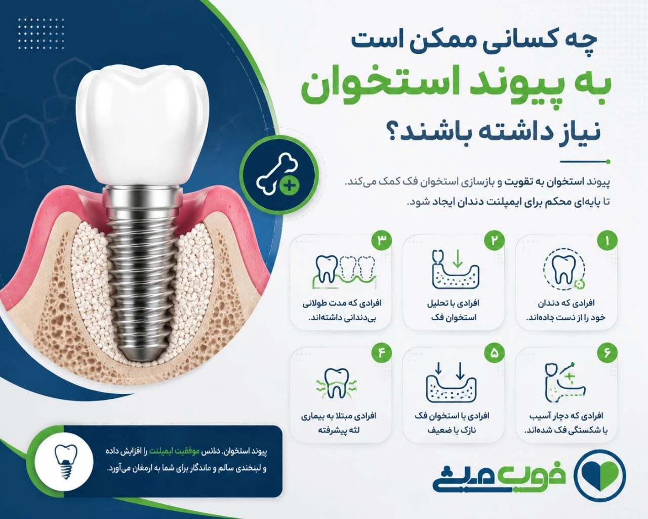 چه کسانی ممکن است به پیوند استخوان نیاز داشته باشند؟
