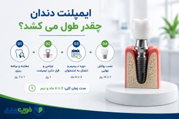 ایمپلنت دندان چقدر طول می کشد؟