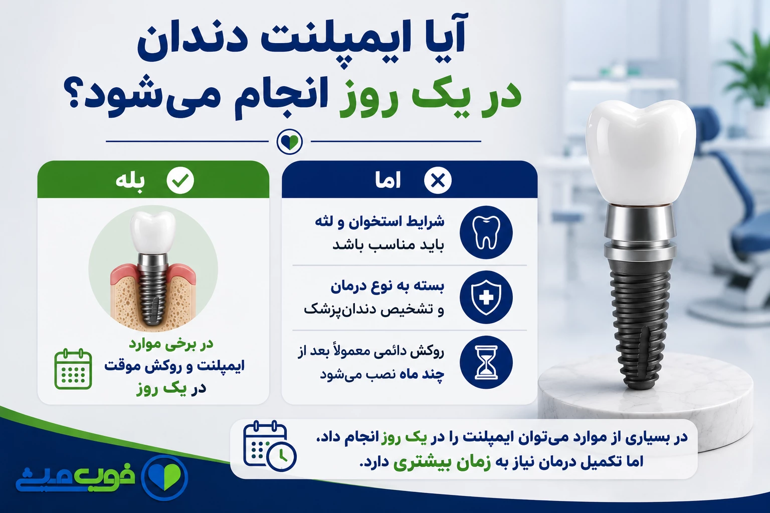 آیا ایمپلنت دندان در یک روز انجام میشود؟