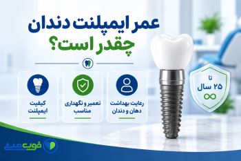 عمر ایمپلنت دندان چقدر است؟ 