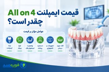 قیمت ایمپلنت All on 4 چقدر است؟