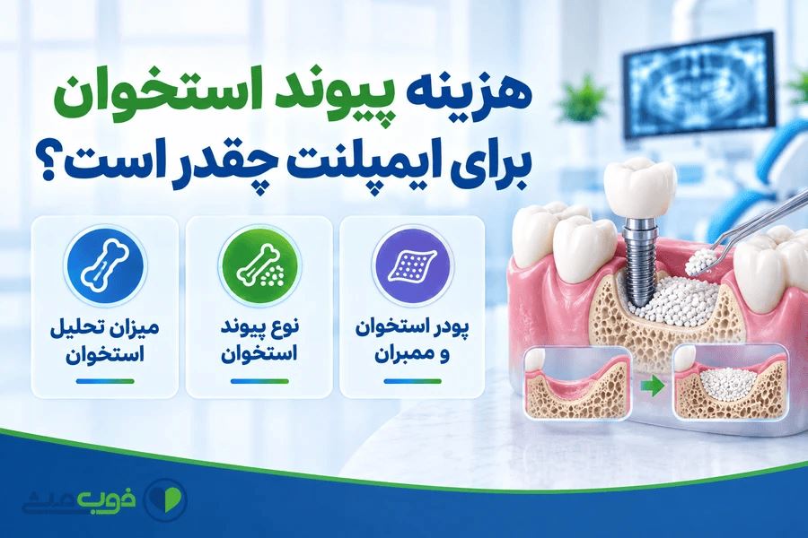 هزینه پیوند استخوان برای ایمپلنت چقدر است؟