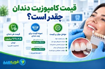 قیمت کامپوزیت دندان چقدر است؟