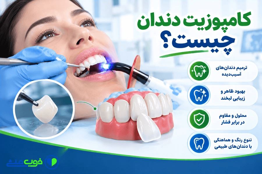 کامپوزیت دندان چیست؟