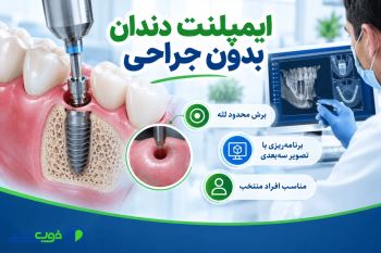 ایمپلنت دندان بدون جراحی