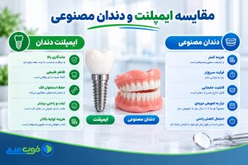 مقایسه ایمپلنت و دندان مصنوعی