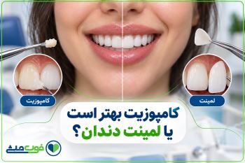 کامپوزیت بهتر است یا لمینت دندان؟
