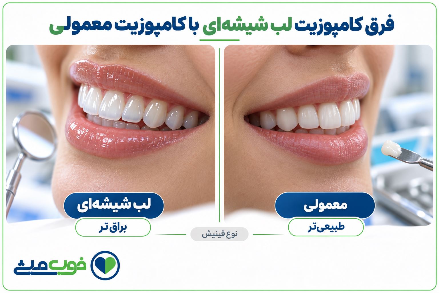فرق کامپوزیت لب شیشه‌ای با کامپوزیت معمولی