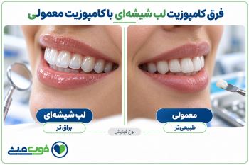 فرق کامپوزیت لب شیشه‌ای با کامپوزیت معمولی