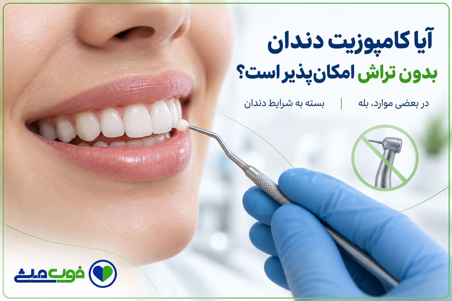 آیا کامپوزیت دندان بدون تراش امکان‌پذیر است؟