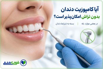آیا کامپوزیت دندان بدون تراش امکان‌پذیر است؟